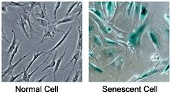细胞衰老检测试剂盒—Cellular Senescence Assay Kit (SA-ß-Gal Activity)