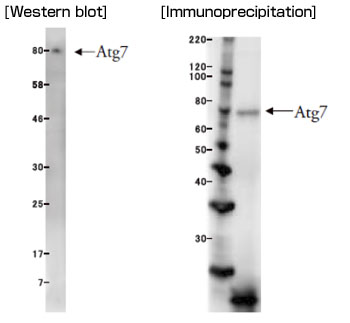 抗 Atg7 单克隆抗体（克隆号：ATG7-2）                              Anti Atg7 (Clone: ATG7-2) Monoclonal antibody