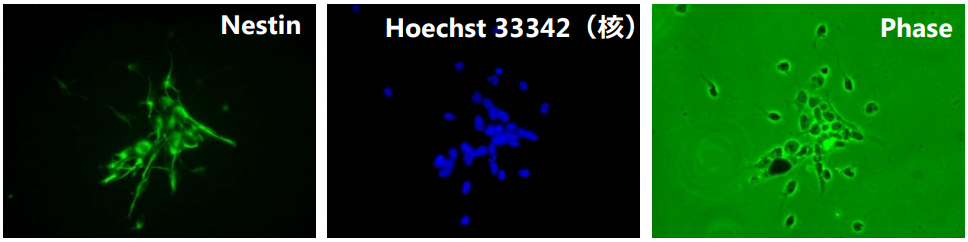 抗小鼠Nestin，大鼠单克隆抗体（7A3）                              神经干细胞标记物