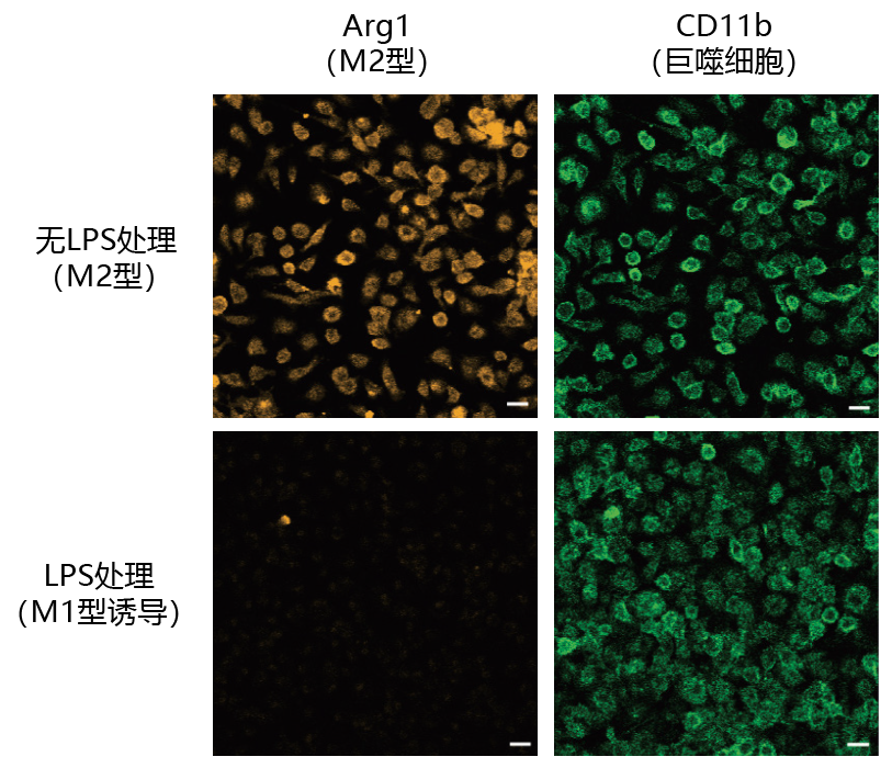 抗 iNOS 多抗 • 抗 Arg1 多抗                              应用于巨噬细胞的免疫细胞染色