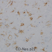 抗Iba1, 重组兔源单克隆抗体（6A4）                              Anti Iba1, Rabbit Monoclonal Antibody (6A4), recombinant