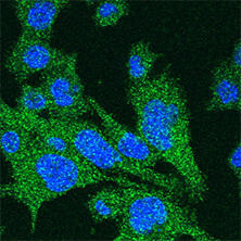 抗Iba1, 重组兔源单克隆抗体（6A4）                              Anti Iba1, Rabbit Monoclonal Antibody (6A4), recombinant