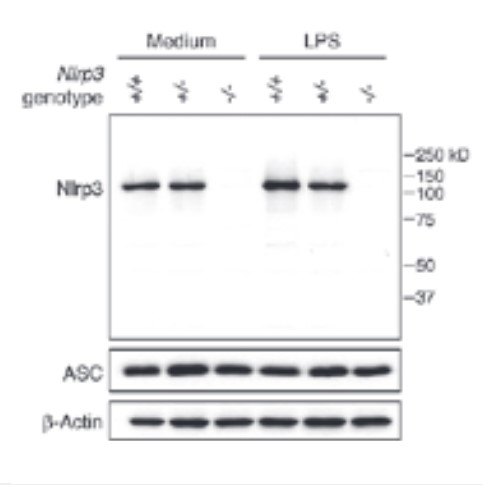 炎性小体信号通路——从先天到适应性免疫（Adipogen）